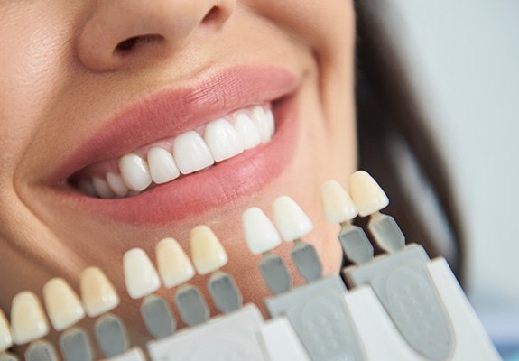 A woman having her smile assessed with a dental shade guide